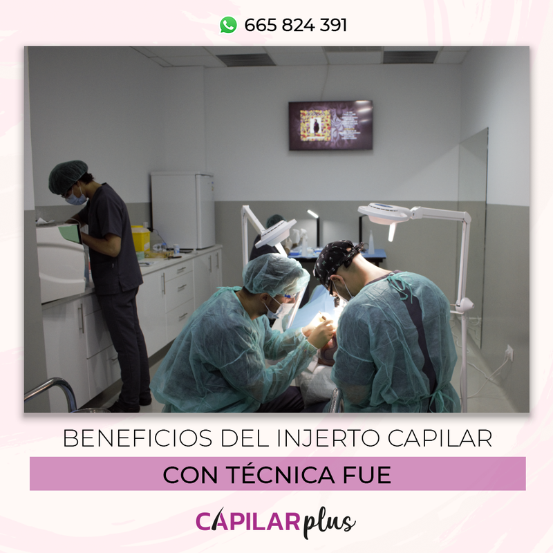 beneficios del injerto capilar con tecnica fue