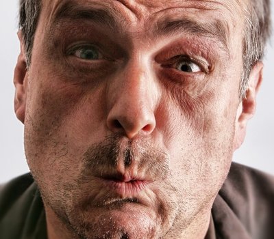 C�mo eliminar el mal aliento