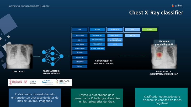 Presentación Ángel Alberich - Quibim